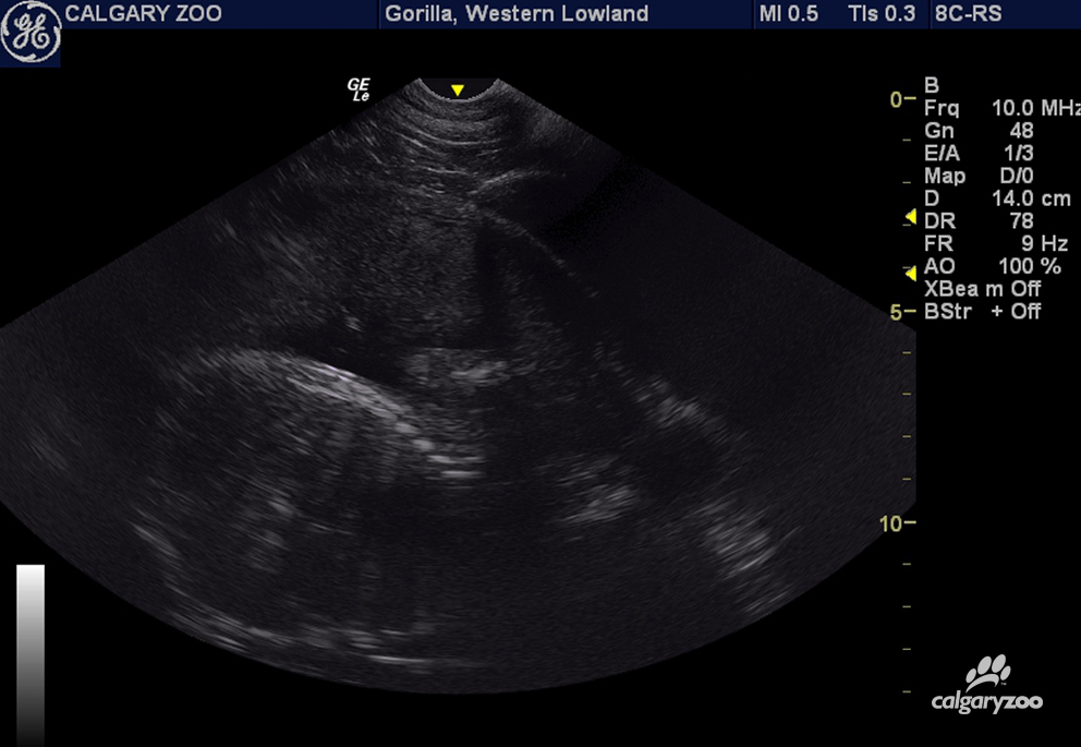 KiojaUltrasound2015WM