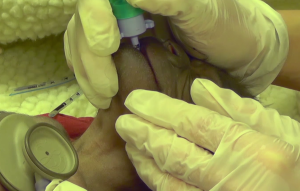 Screen Shot 2016-02-24 at 10.56.20 AM