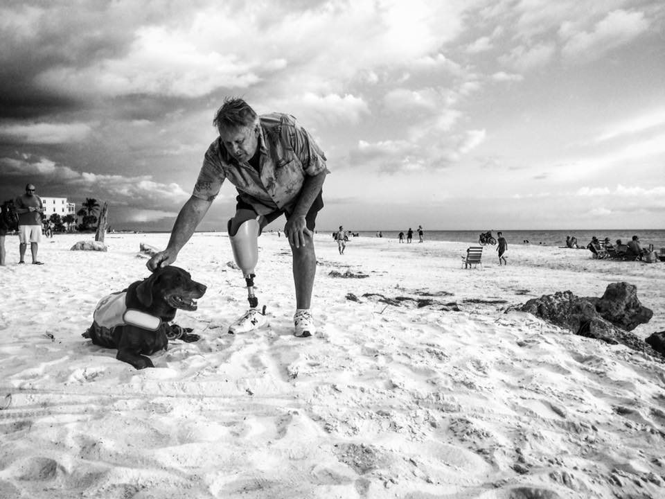 Recent below the knee amputee after something as simple as a broken foot became infected to the point of no repair. It's moments like this that keep me so inspired to continue to share Bella's enduring spirit. Robert Kugler/Facebook